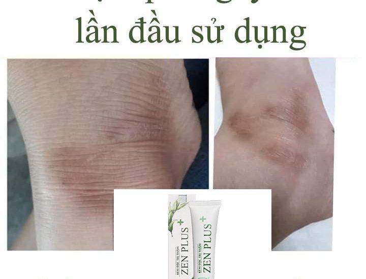 Mỹ phẩm Zen có tốt không, giá bao nhiêu, mua ở đâu?